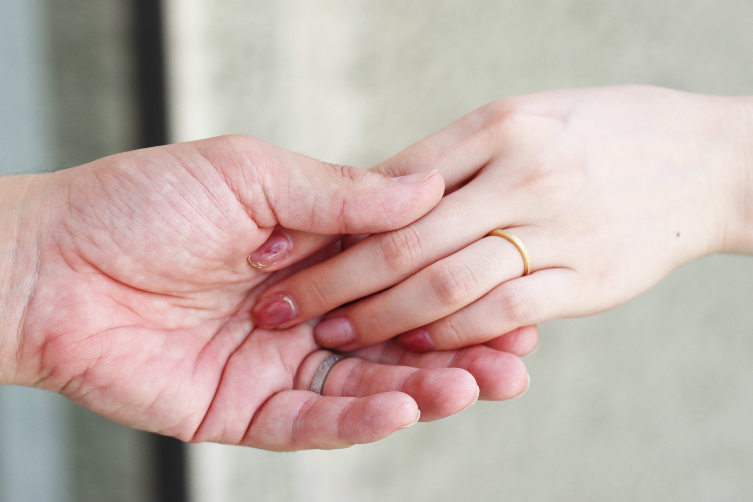 エトナのリングをはめたカップルの手の写真